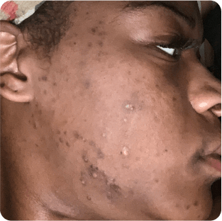 before image of BreAnna