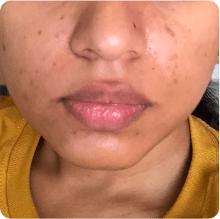 before image of Mohinur